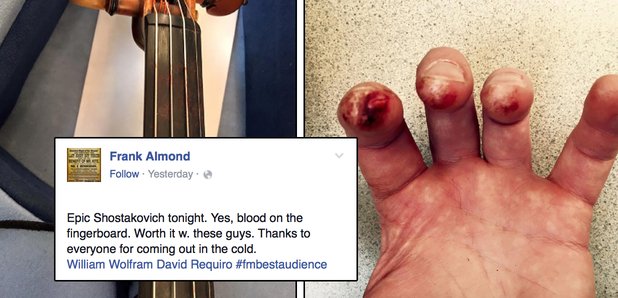 blood on violin